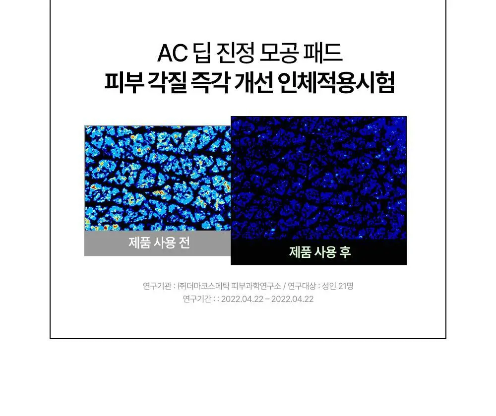 [트러블/진정] 듀이트리 AC 딥 진정 모공 패드 60매 기획 (+20매 증정) 상세페이지 22